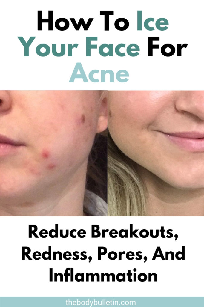 I Tried Ice On My Face For Acne - Here's What Happened • The Body Bulletin