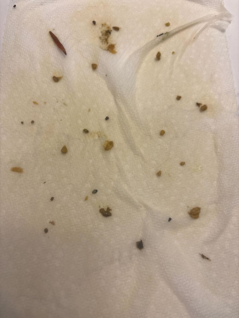 How to Cleanse Your Liver Naturally At Home