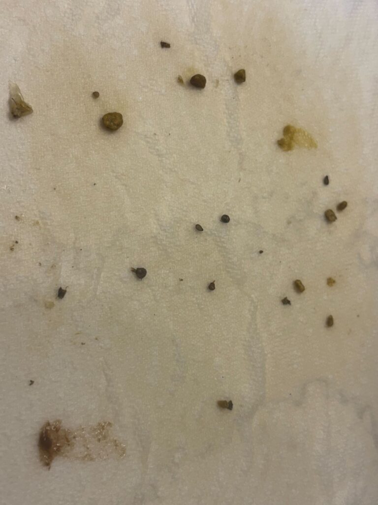 How to Cleanse Your Liver Naturally At Home