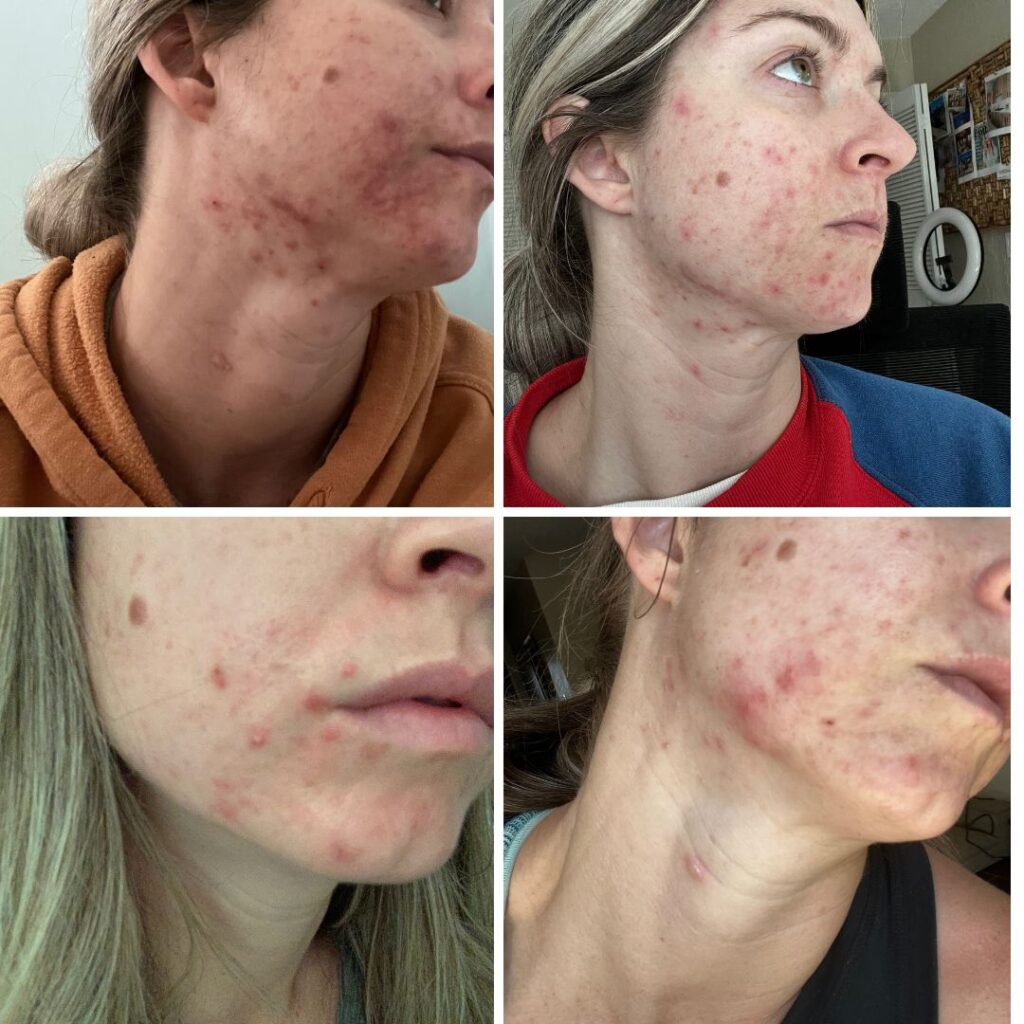 How to do a parasite cleanse naturally