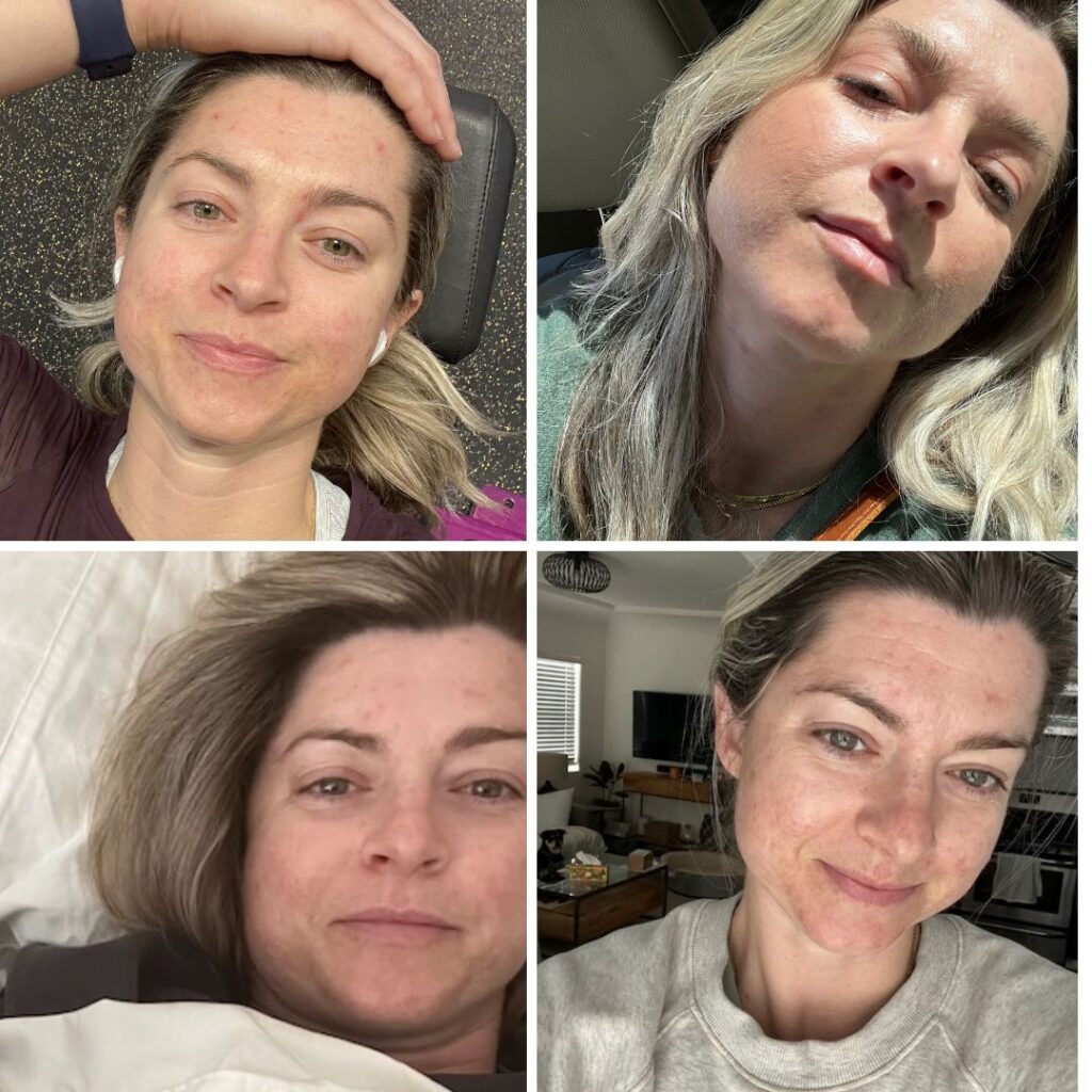 How to do a parasite cleanse naturally